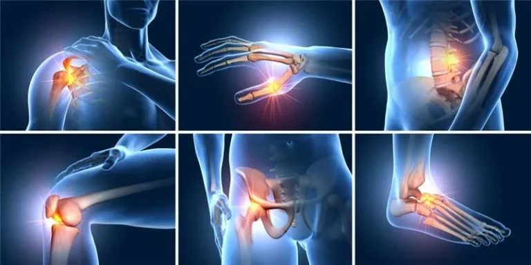Joint Pain Treatment in NYC