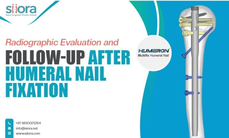 Radiographic Evaluation and Follow-Up After Humeral Nail Fixation